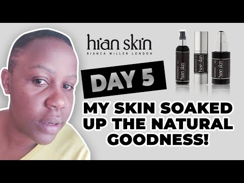 Day 5 - My Skin Soaked Up The Godness - Hian Skin - Bianca Miller London