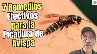 🐝🩹 ¡ALIVIO YA! 7 REMEDIOS CASEROS EFECTIVOS para la PICADURA de AVISPA ✨💧