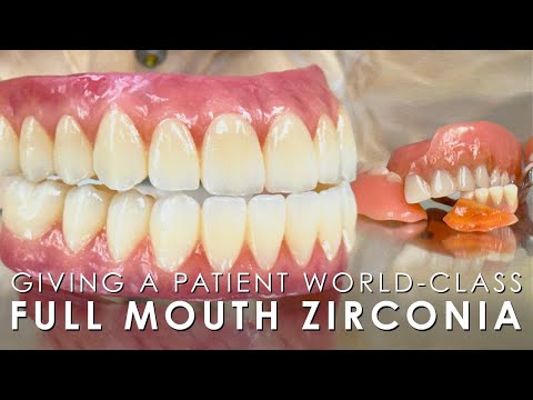 Giving a Patient World-Class Full Mouth Zirconia Implants