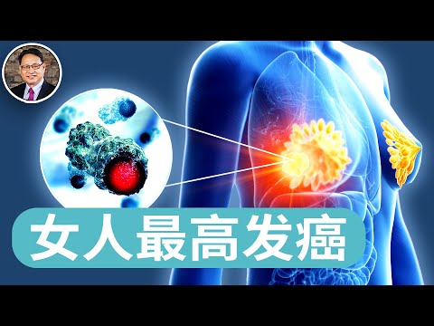 每分鐘4人確診！全球女性最高發癌症，如何預防與調理？｜四維健康