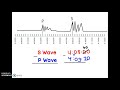 Lag Time Calculation in Seismology