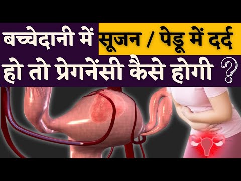 बच्चेदानी में सूजन हो तो प्रेगनेंसी कैसे होगी - Pelvic Pain & uterus swelling tips #prerna #uterus