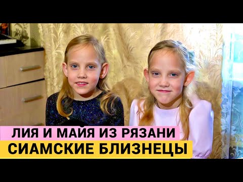 ОНИ ЖЕ СРОСЛИСЬ, А НЕ ОБНИМАЮТСЯ! - ахнула доктор на УЗИ. Сиамским близнецам идет 9 год.