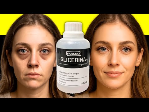 PASSEI na RUGA dos OLHOS e DESISTI da PLÁSTICA - SOME RUGA de 70 ANOS!