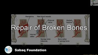 Repair of Broken Bones