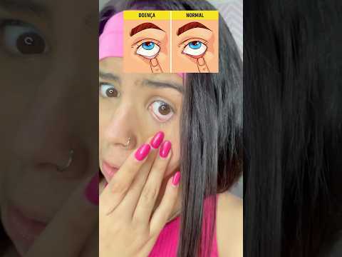 SEU OLHO É QUAL? DOENTE OU NORMAL? 😨 (#SHORTS ) - BELLA HANUC
