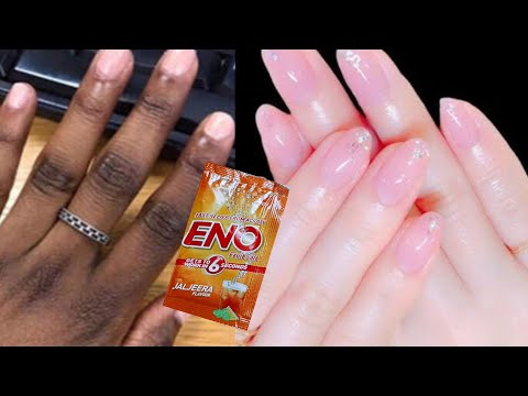 Hand whitening secret tips | Hand whitening cream at home | Hand whitening home remedy