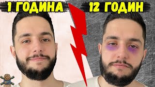 СТРІМ З ПРОДОВЖЕННЯМ 🔥 WoT Blitz (запис 17.08.25)