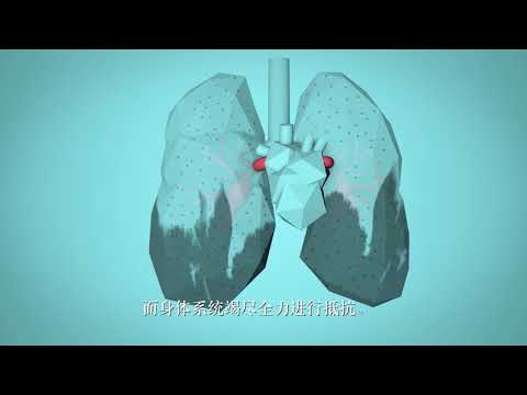 世衛組織：“生命呼吸”——空氣污染如何影響您的身體 - YouTube(1:18)