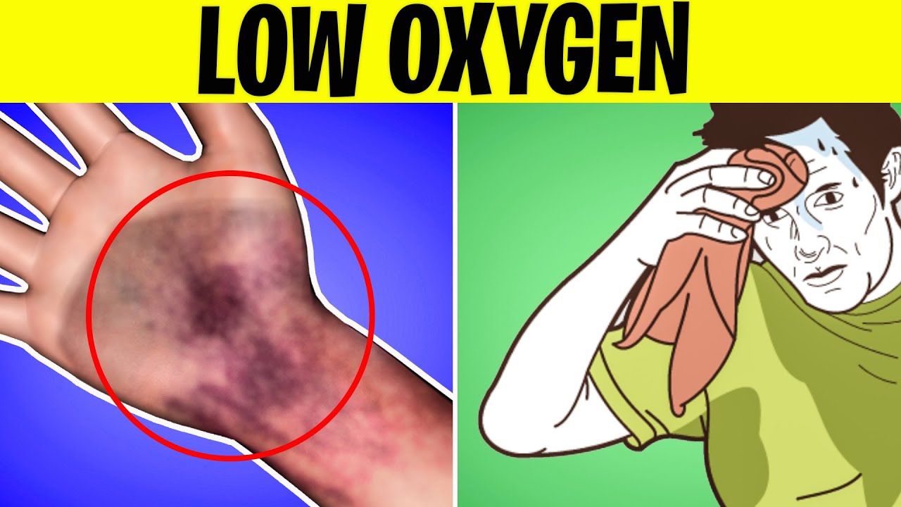8 Warning Signs of Low Oxygen in Your Blood