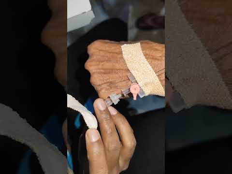 IV Cannulation Procedures technique video #viral #shorts #video