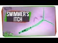 Understanding Swimmer's Itch and Parasites