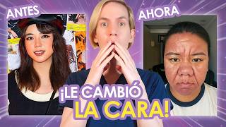 QUEDÓ EMBARAZADA y SE LE DEFORMÓ LA CARA - El caso de Farrah Faizal - ¿Qué le pasó? ¿TE PUEDE PASAR?