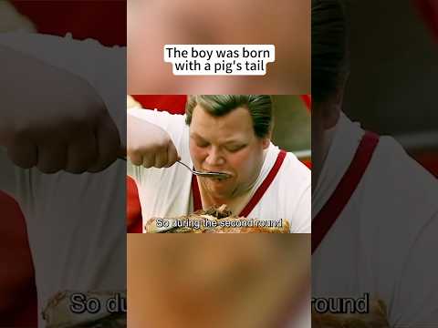 #shorts The boy was born with a pig's tail