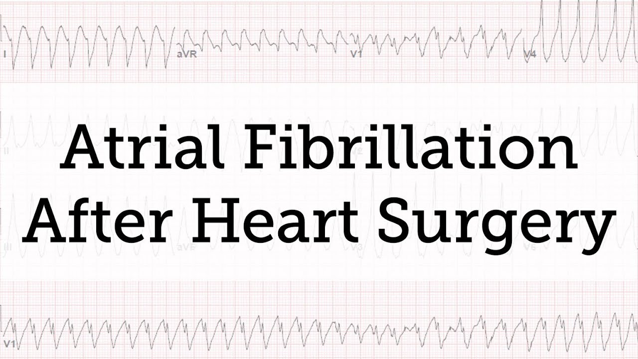 How Long Does Afib Last After Open Heart Surgery
