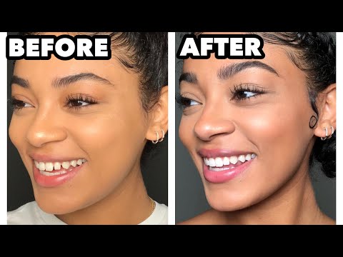 HOW I CLOSED THE GAPS IN MY TEETH! Quick & Easy | jasmeannnn