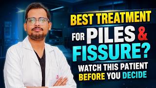 Best Treatment for Piles & Fissure | Watch This Patient Before You Decide