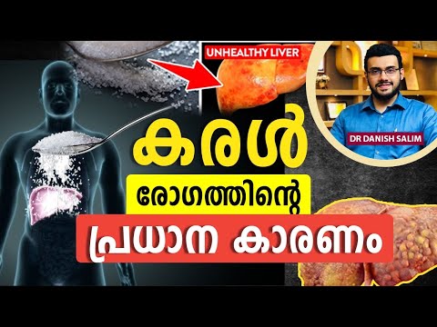 2116: കരൾ രോഗത്തിത്തിന്റെ പ്രധാന കാരണം | Most important reason for liver disease