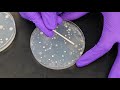 Bacterial Streaking Techniques and Analysis