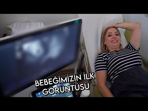 BEBEĞİMİZİN İLK KONTROLÜ !! BEBEĞİMİZİ GÖRDÜK