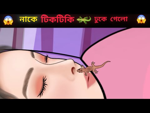 ঘুমানোর সময় নাকে টিকটিকি 🦎 ঢুকে গেল 😱