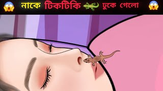 ঘুমানোর সময় নাকে টিকটিকি 🦎 ঢুকে গেল 😱