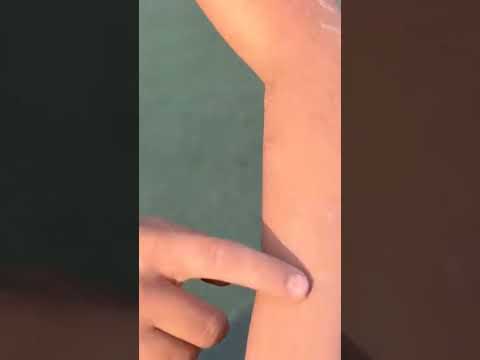 مشاجره شديده بين حسن وبيكا داخل الملعب ادت الي اصابات حسن