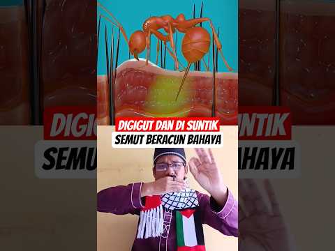 Ternyata begini rasanya digigit dan disuntik semut beracun #ants #science #biology #facts #insects