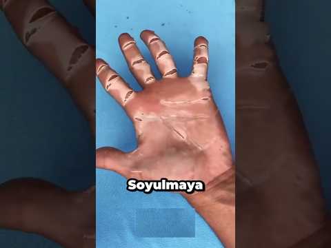 Cildinize Bunu ASLA Yapmayın 😱