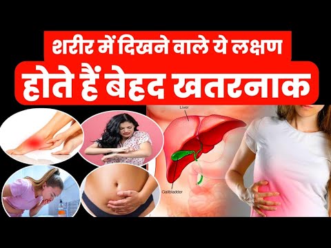 शरीर में दिखने वाले ये लक्षण होते हैं बेहद खतरनाक|liver mein kharabi hone ke lakshan|