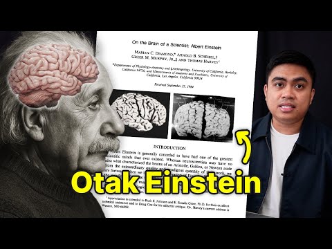 Setelah meninggal dunia, otak Einstein dicuri, lalu diteliti. Ini hasilnya.