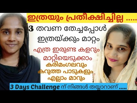 😱ഇത്രയും പ്രതീക്ഷിച്ചില്ല 3തവണ തേച്ചപ്പോൾ ഇത്രയും മാറ്റം|Skin whitening face pack #skinwhitening