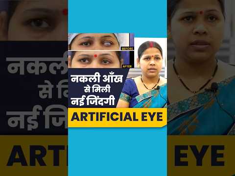 Artificial eye
