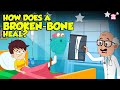 Bone Healing and Fracture Repair