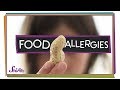 Understanding Food Allergies
