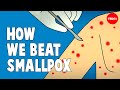 Smallpox Vaccine and Eradication
