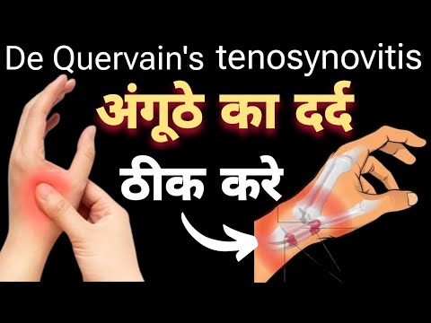 अंगूठे का दर्द कैसे ठीक करे।Thumb Pain Relief Exercise inhindi.De Quervain's tenosynovitis#thumbpain