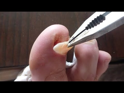 If you finish this video you can win Something