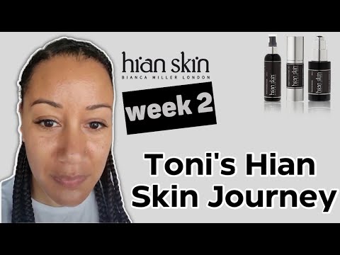 Toni's Hian Skin Journey Week Two: Seeing Significant Improvement - Hian Skin - Bianca Miller London
