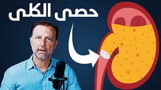بروتوكول التخلص من حصوات الكلية ومنعها بطريقة مثبتة علمياً