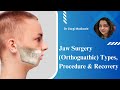 Jaw Surgery Knowledge Assessment