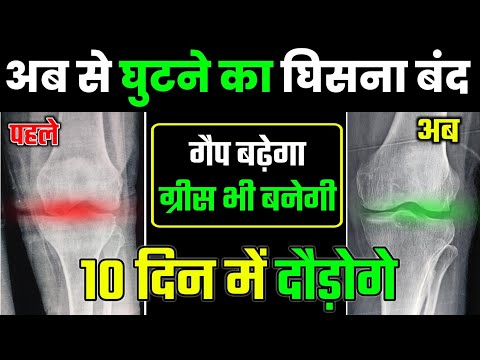 घिसे हुए घुटने का गैप बढ़ाएं बिना सर्जरी के|Knee Pain Exercises|Knee Joint Pain Relief Exercises