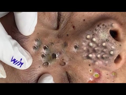 طرق حماية بشرة الوجهCC550