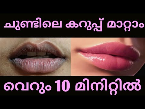 എത്ര കറുത്ത ചുണ്ടും ചുവന്നു തുടുക്കാൻ l Get Pink Lips in 1 Use l Lighten Dark Lips Naturally @ Home