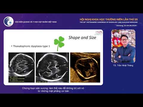 4. Chứng loạn sản xương: làm thế nào để không bỏ sót nó (TS. Trần Nhật Thăng)