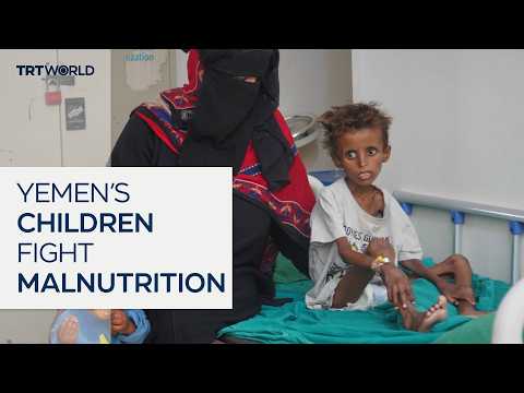 Yemen’s malnutrition crisis threatens millions of children