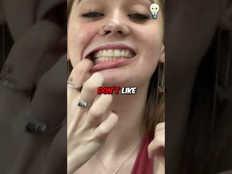 How To Get White Teeth!?