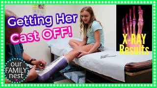GETTING HER CAST OFF & HAD TO GET A NEW ONE!