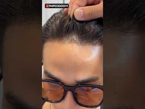  Short hairstyle, hair Patch #hair #hairstyle #viral #you #me #sharma