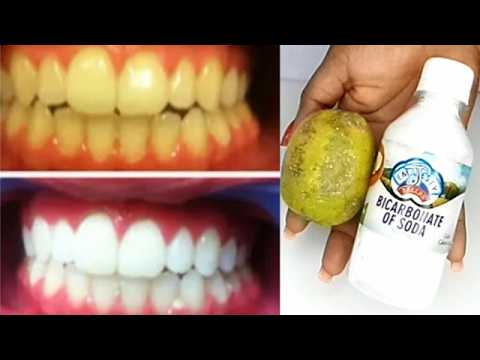 how to remove  dental plaque from teeth whitening teeth at home